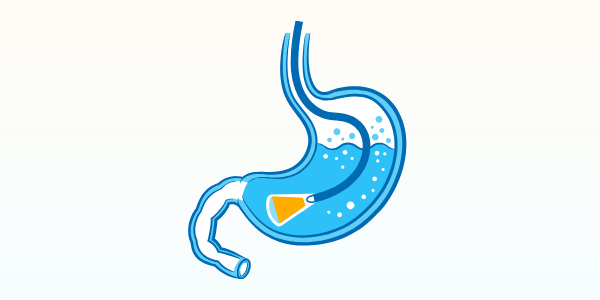 101655 noi soi tieu hoa