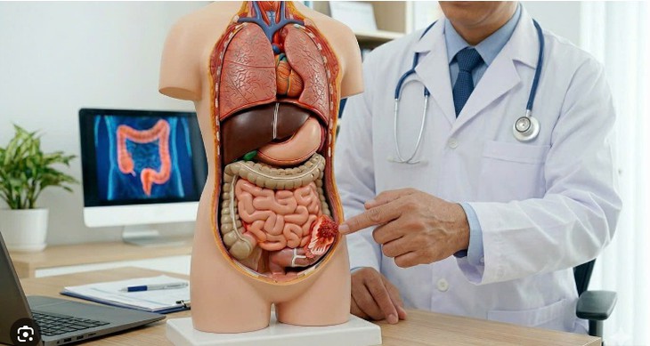 Minh họa tầm soát và phát hiện sớm ung thư đại tràng