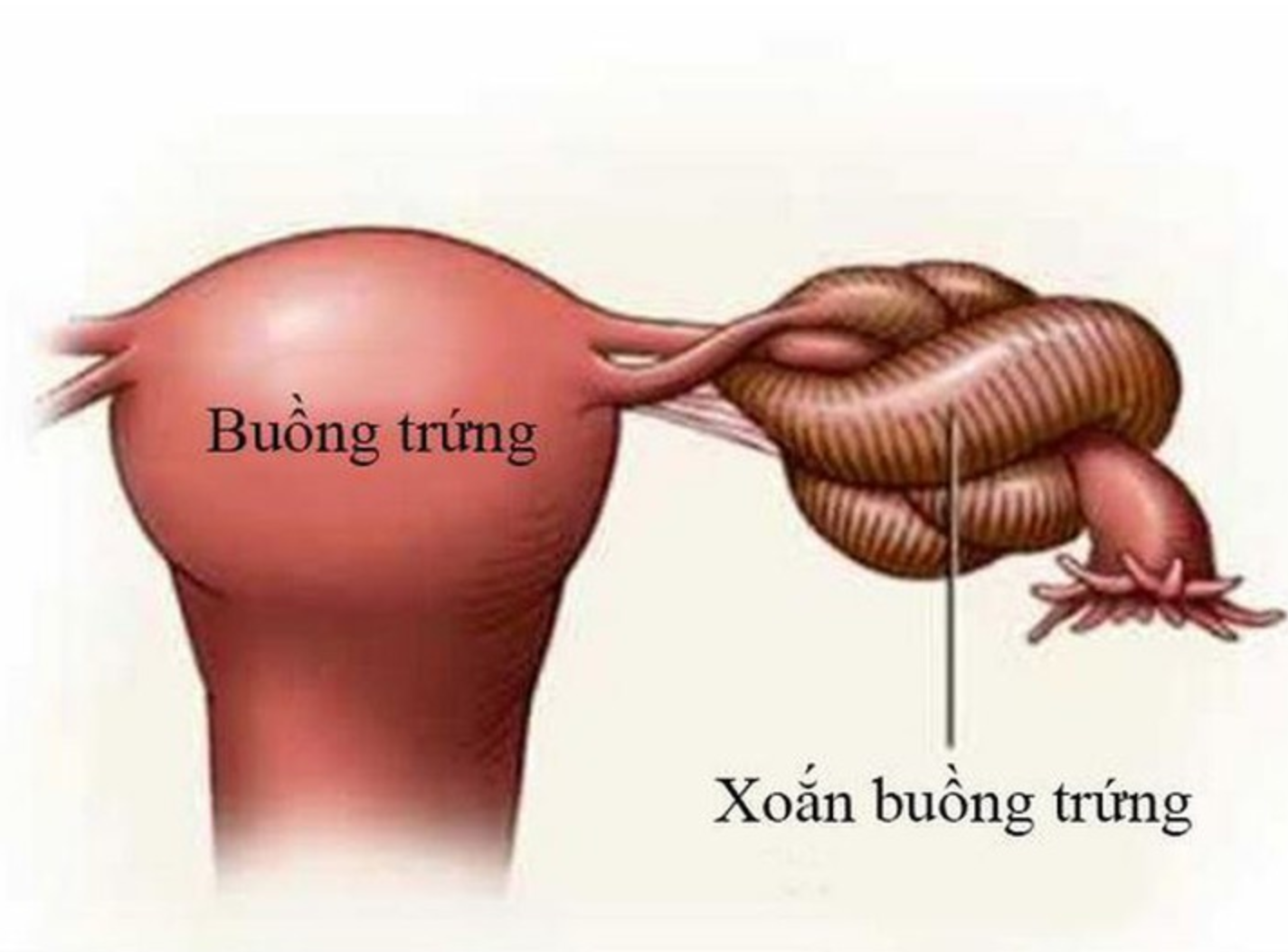 1 4